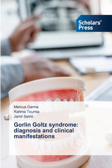 GORLIN GOLTZ SYNDROME