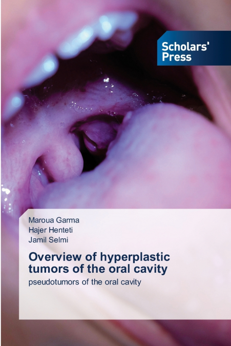 OVERVIEW OF HYPERPLASTIC TUMORS OF THE ORAL CAVITY