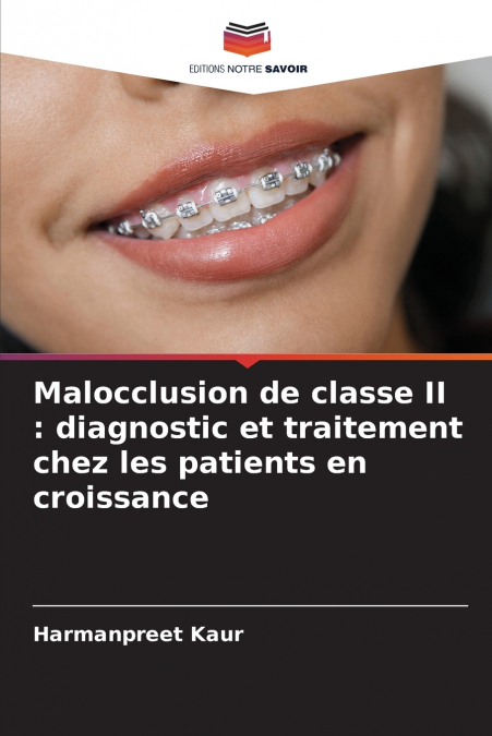 MALOCCLUSION DE CLASSE II