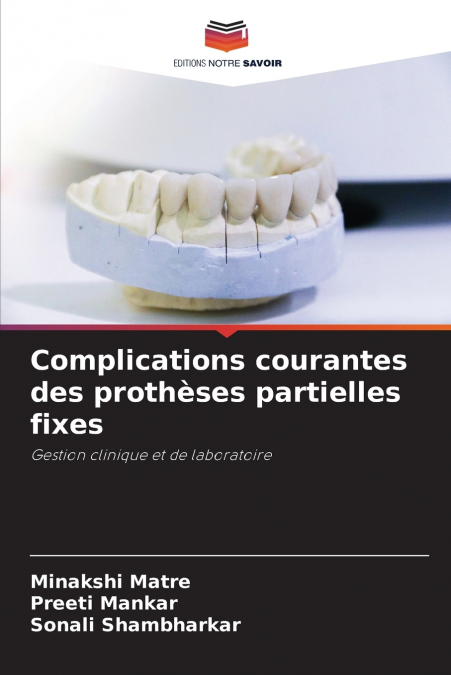 COMMON COMPLICATIONS IN FIXED PARTIAL DENTURES