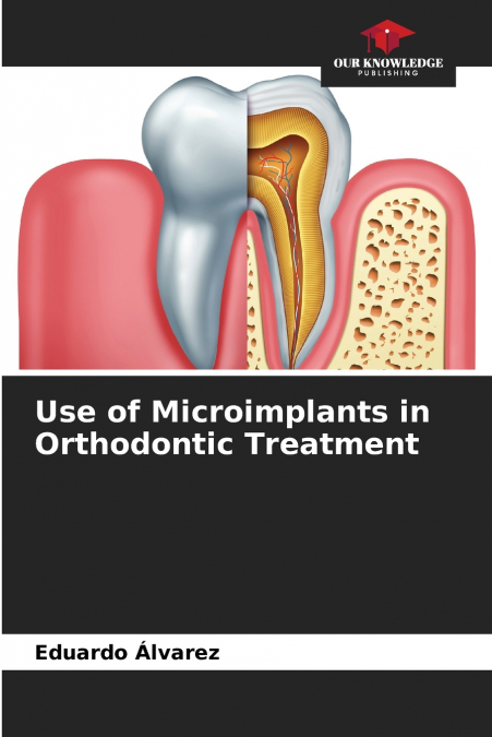 USE OF MICROIMPLANTS IN ORTHODONTIC TREATMENT