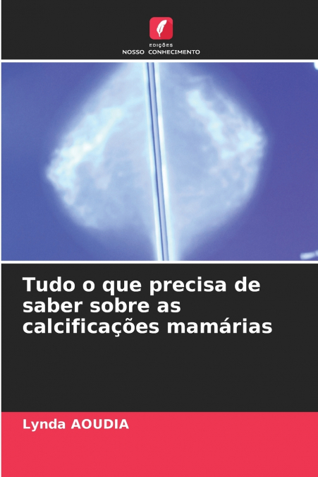 TUDO O QUE PRECISA DE SABER SOBRE AS CALCIFICA�OES MAMARIAS