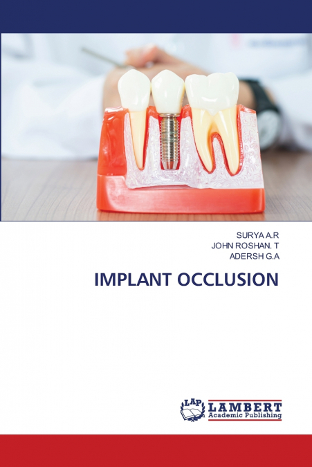 IMPLANT OCCLUSION