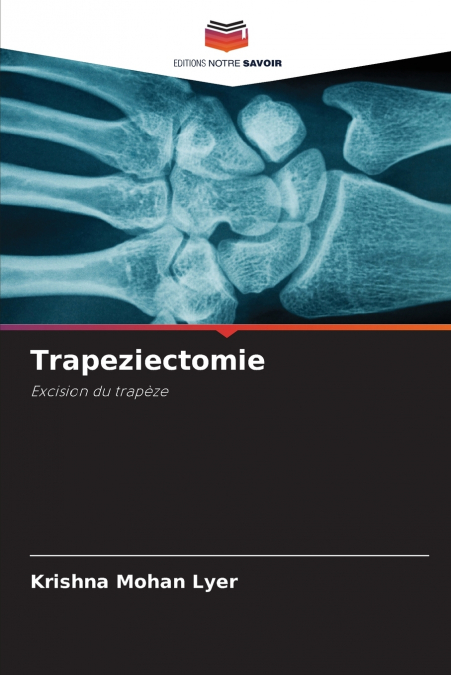 TRAPEZIECTOMIE