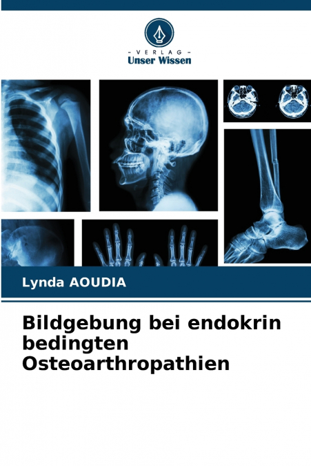 BILDGEBUNG BEI ENDOKRIN BEDINGTEN OSTEOARTHROPATHIEN
