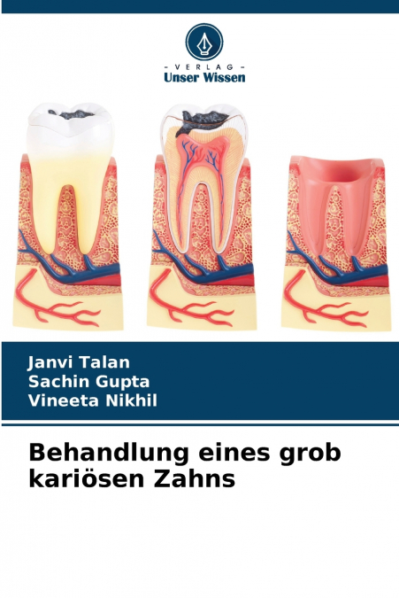 TRATAMENTO DE DENTES COM CARIES GROSSEIRAS