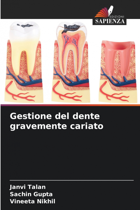 TRATAMENTO DE DENTES COM CARIES GROSSEIRAS