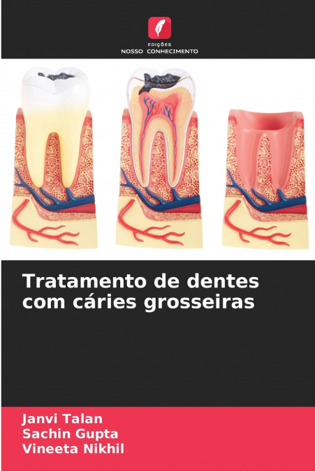 TRATAMENTO DE DENTES COM CARIES GROSSEIRAS
