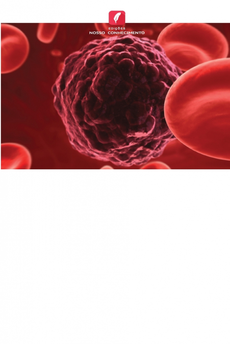 TUMOR DE CELULAS REDONDAS
