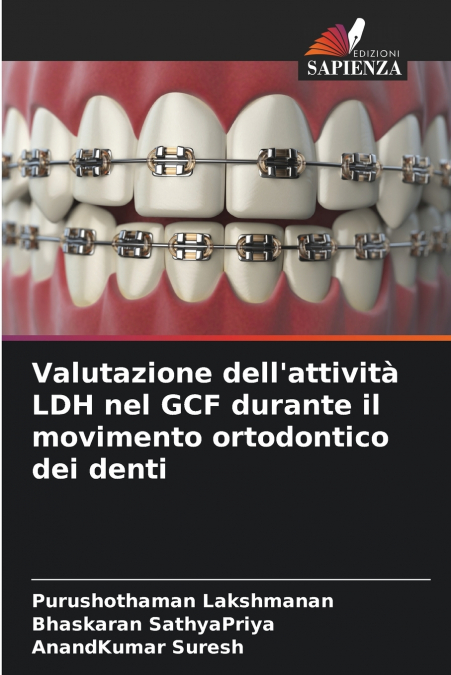 VALUTAZIONE DELL?ATTIVITA LDH NEL GCF DURANTE IL MOVIMENTO O