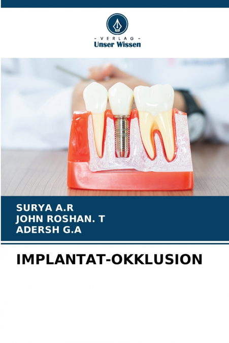 IMPLANT OCCLUSION