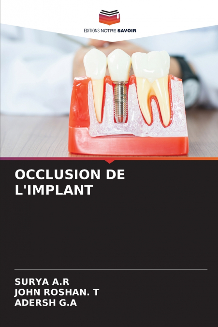 IMPLANT OCCLUSION