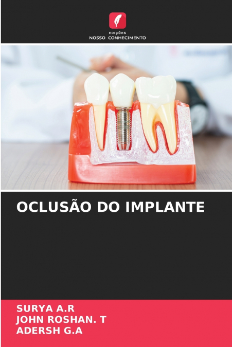 IMPLANT OCCLUSION