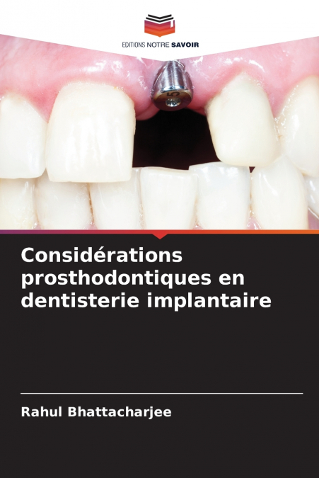 CONSIDERATIONS PROSTHODONTIQUES EN DENTISTERIE IMPLANTAIRE