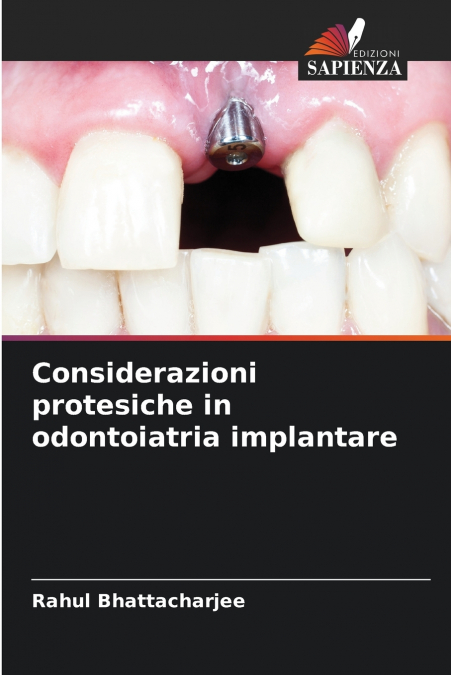 CONSIDERAZIONI PROTESICHE IN ODONTOIATRIA IMPLANTARE