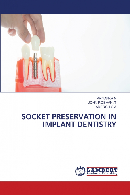 SOCKET PRESERVATION IN IMPLANT DENTISTRY