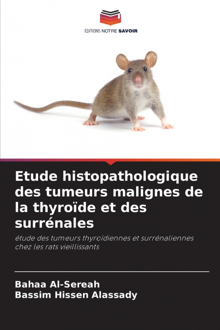 ETUDE HISTOPATHOLOGIQUE DES TUMEURS MALIGNES DE LA THYROIDE