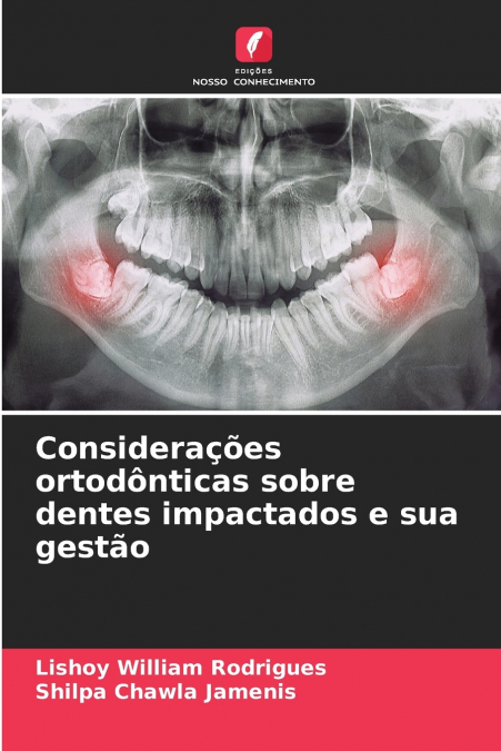 CONSIDERA�OES ORTODONTICAS SOBRE DENTES IMPACTADOS E SUA GES