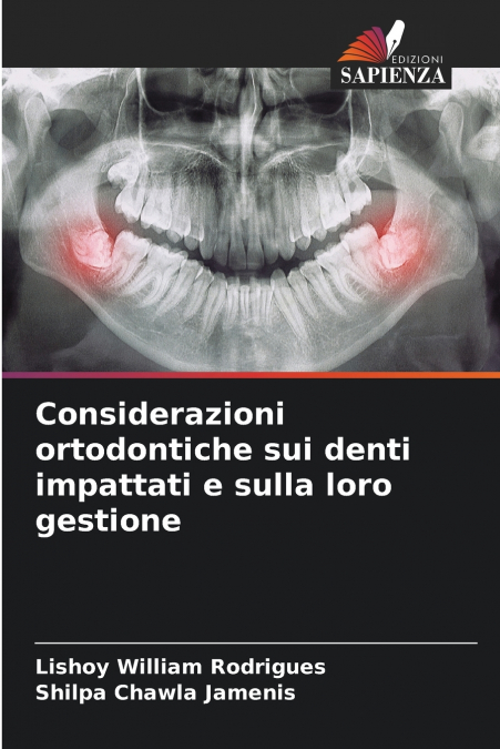 CONSIDERAZIONI ORTODONTICHE SUI DENTI IMPATTATI E SULLA LORO