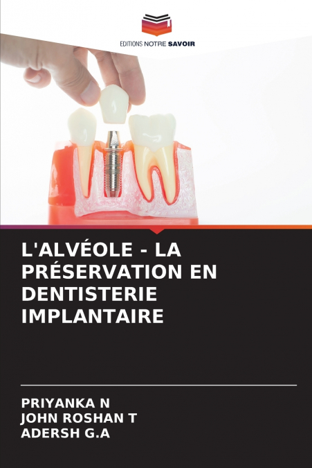 SOCKET PRESERVATION IN IMPLANT DENTISTRY