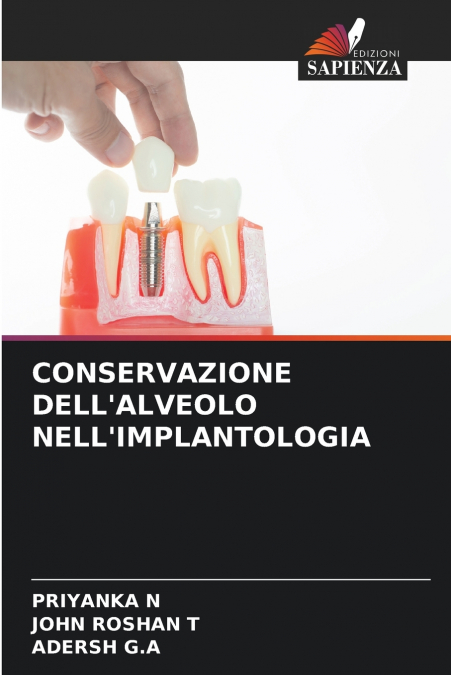 SOCKET PRESERVATION IN IMPLANT DENTISTRY