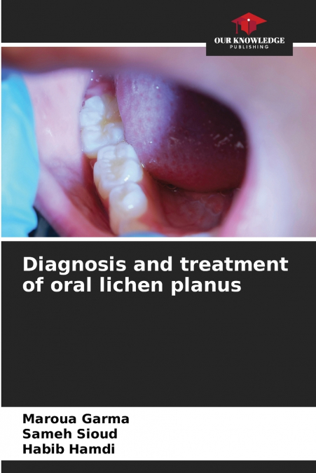 DIAGNOSI E TRATTAMENTO DEL LICHEN PLANUS ORALE