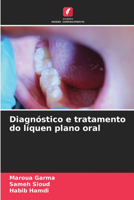 DIAGNOSTICO E TRATAMENTO DO LIQUEN PLANO ORAL