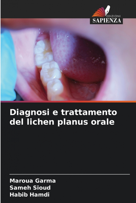 DIAGNOSI E TRATTAMENTO DEL LICHEN PLANUS ORALE