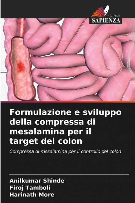 FORMULATION, DEVELOPPEMENT D?UN COMPRIME DE MESALAMINE POUR