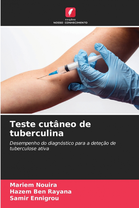 TESTE CUTANEO DE TUBERCULINA