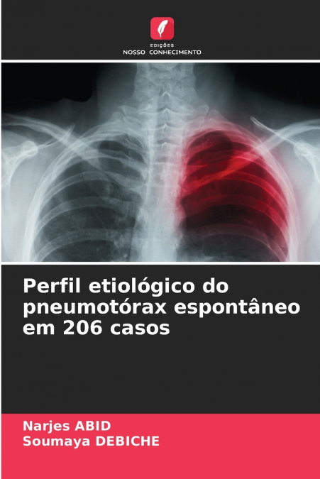 PERFIL ETIOLOGICO DO PNEUMOTORAX ESPONTANEO EM 206 CASOS