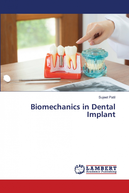 BIOMECCANICA DEGLI IMPIANTI DENTALI
