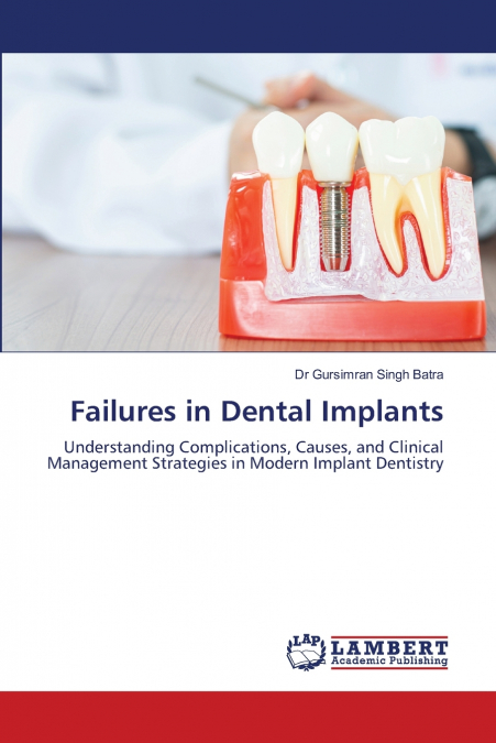 FAILURES IN DENTAL IMPLANTS