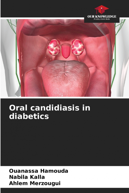 ORAL CANDIDIASIS IN DIABETICS