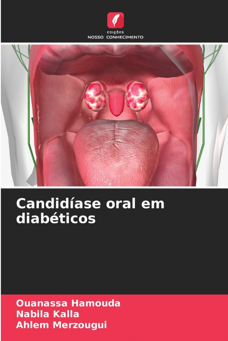 CANDIDIASE ORAL EM DIABETICOS