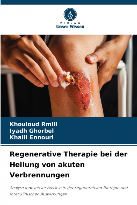 REGENERATIVE THERAPIE BEI DER HEILUNG VON AKUTEN VERBRENNUNG