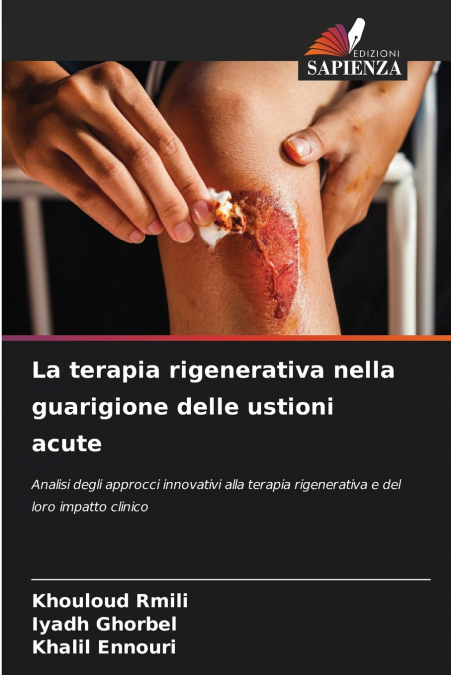 LA TERAPIA RIGENERATIVA NELLA GUARIGIONE DELLE USTIONI ACUTE