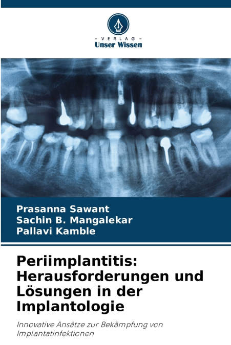 PERIIMPLANTITIS