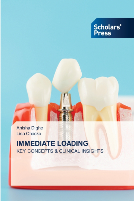 LES PROTOCOLES DE MISE EN CHARGE EN DENTISTERIE IMPLANTAIRE
