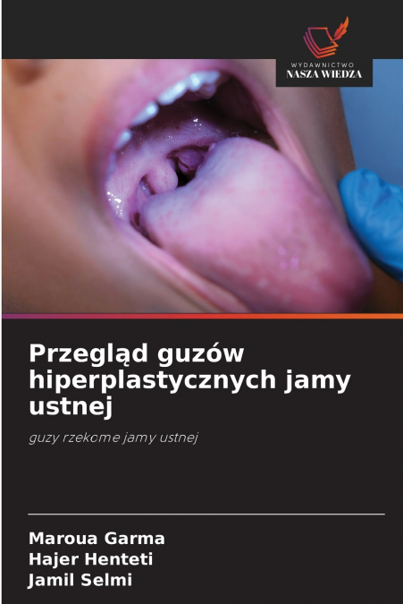 PRZEGL?D GUZOW HIPERPLASTYCZNYCH JAMY USTNEJ