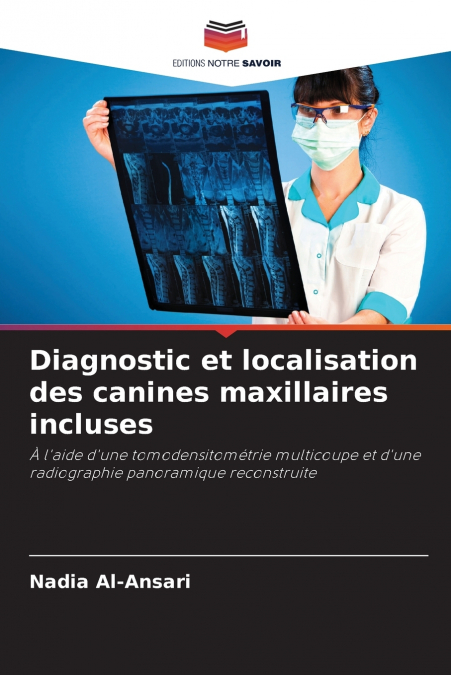 DIAGNOSTIC ET LOCALISATION DES CANINES MAXILLAIRES INCLUSES