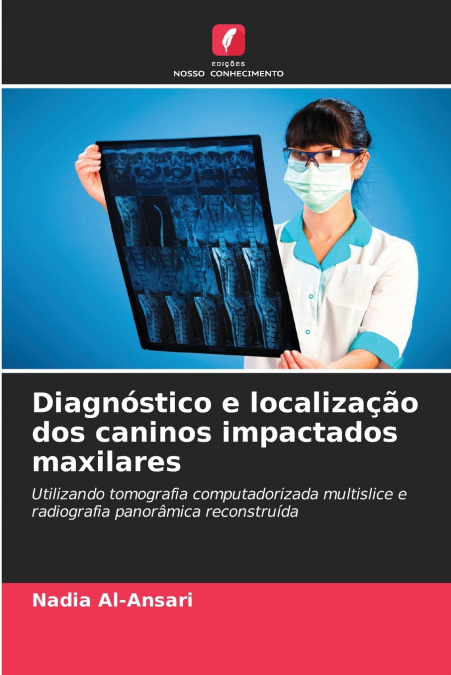 DIAGNOSTICO E LOCALIZA�AO DOS CANINOS IMPACTADOS MAXILARES