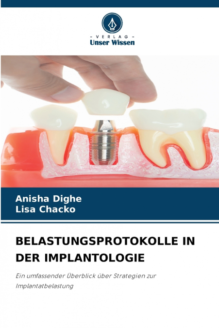 BELASTUNGSPROTOKOLLE IN DER IMPLANTOLOGIE