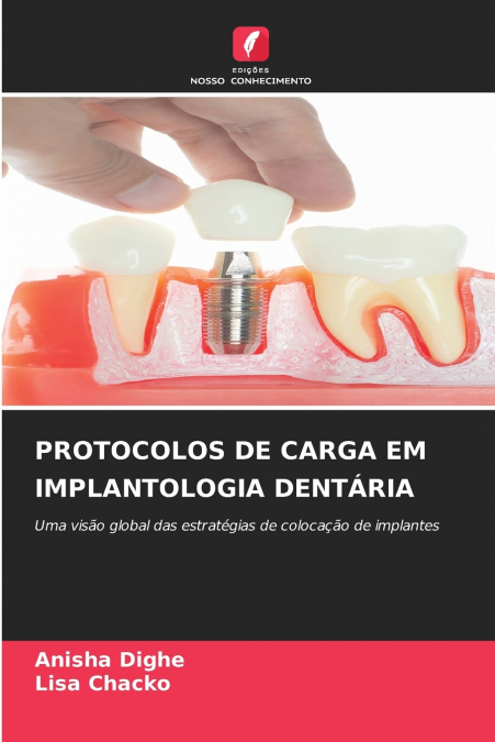 PROTOCOLOS DE CARGA EM IMPLANTOLOGIA DENTARIA
