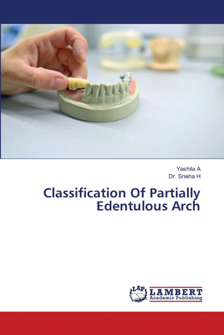 CLASSIFICATION OF PARTIALLY EDENTULOUS ARCH