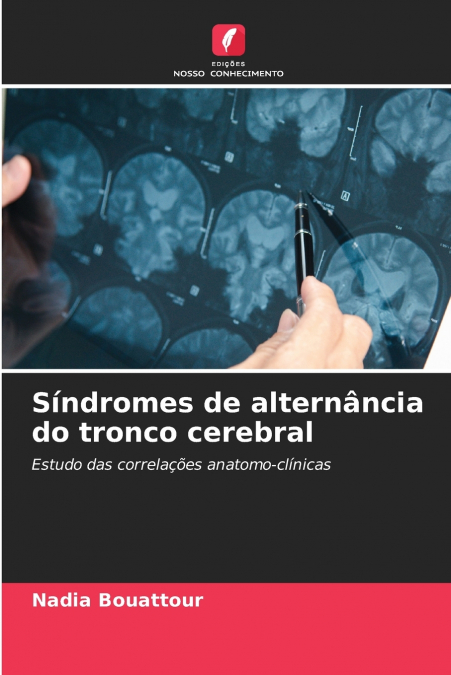 SINDROMES DE ALTERNANCIA DO TRONCO CEREBRAL