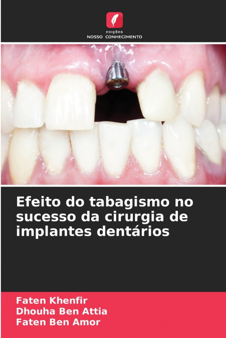 EFEITO DO TABAGISMO NO SUCESSO DA CIRURGIA DE IMPLANTES DENT
