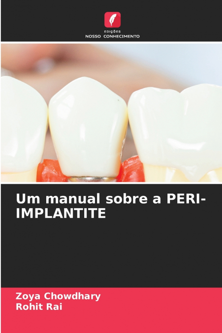UM MANUAL SOBRE A PERI-IMPLANTITE