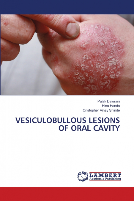 VESICULOBULLOUS LESIONS OF ORAL CAVITY