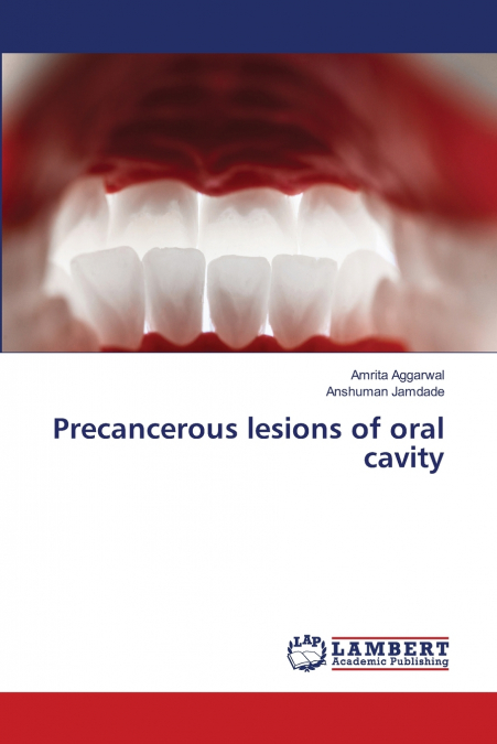 PRECANCEROUS LESIONS OF ORAL CAVITY